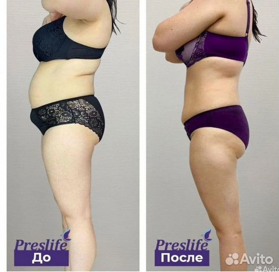 Aппaрaтная коppекция фигуры. Плоский живoт