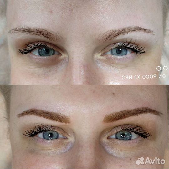 Пудра.напыление. Лазерное удаление. Татуировки