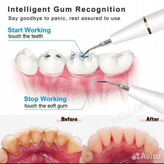 Ультразвуковой скалер