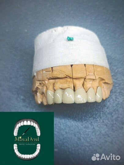 Зубной техник керамист