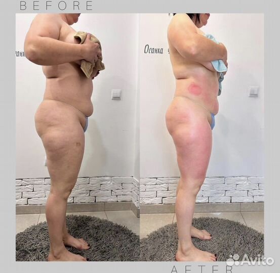 Коррекция фигуры