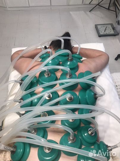 Аппаратный вакуумный массаж