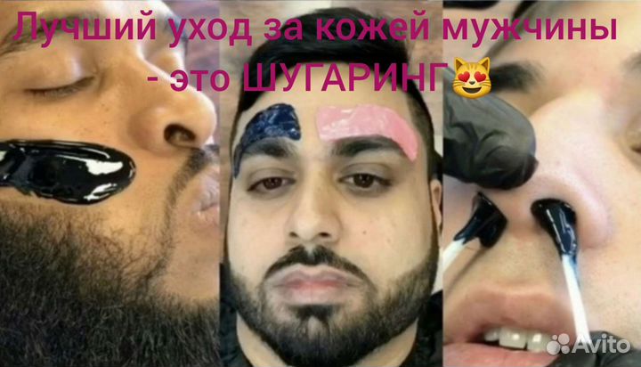 Эпиляция
