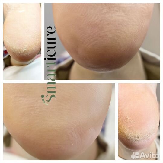 Мужской педикюр и маникюр