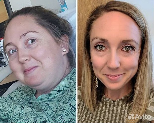 Путь к уменьшению жировой прослойки в Барнауле