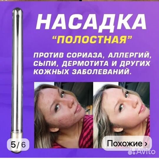 Дарсонваль ДЕ 212 карат