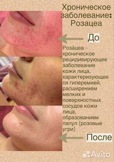Услуги косметолога