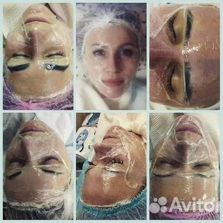 Гель для холодного гидрирования (холодн. распарива