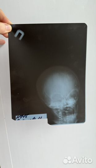 Рентгеновские снимки