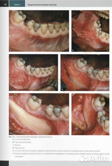Хирургическая стоматология Маттео Кьяпаско
