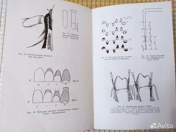 Книга Лечение стоматологических заболеваний