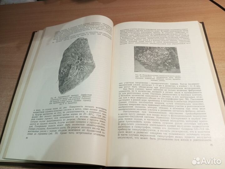 Рентгенодиагностика проф.болезней