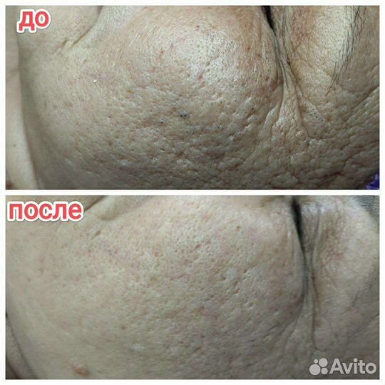 Услуги косметолога