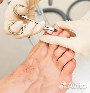 Услуги подолога. Работа с проблемами ногтей и стоп