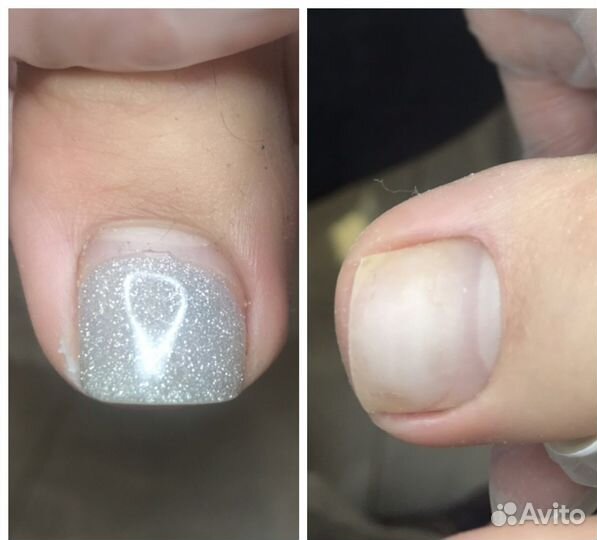 Подолог. Медицинский,Smart педикюр.Сланцы Гдов