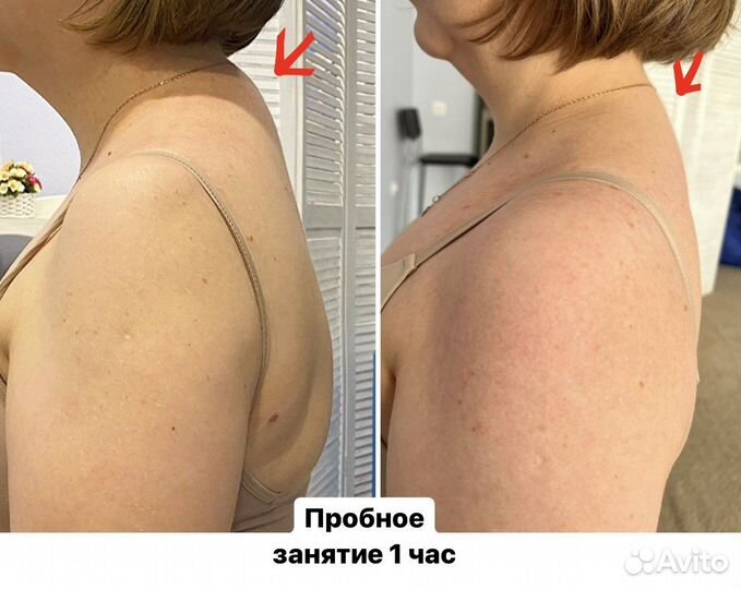 Лечение сколиоза/грыжи/сутулости и др