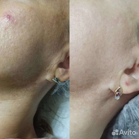 Услуги косметолога