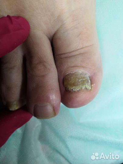 Услуги подолога