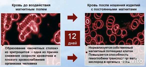 Магнитный браслет
