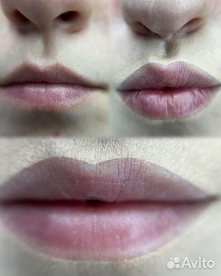 Перманентный макияж Удаление тату