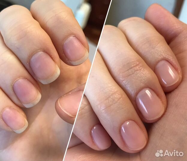 Качественный маникюр/педикюр