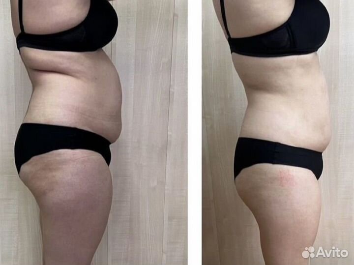 Аппаратное похудение, Массаж 