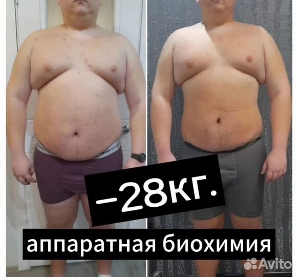 Массаж антицеллюлитный Коррекция фигуры