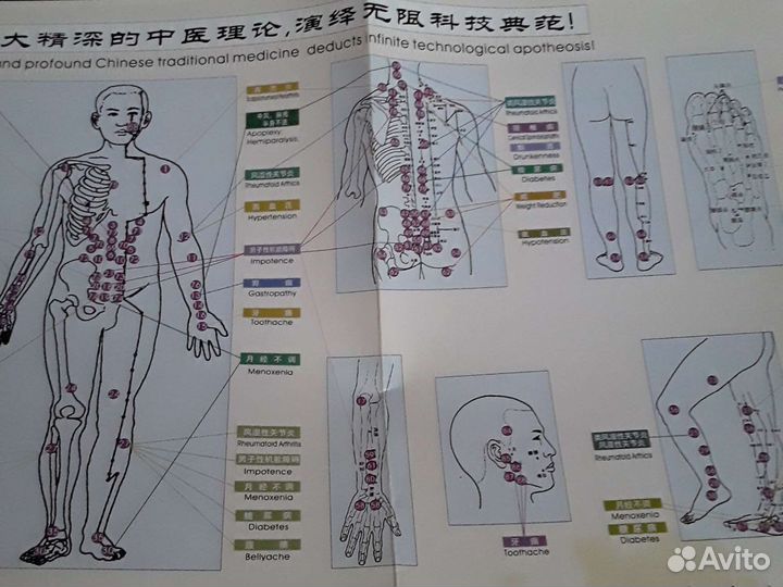 Медицинские изделия