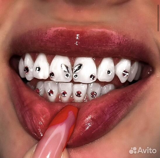 Установка скайсов