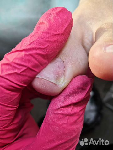 Услуги подолога