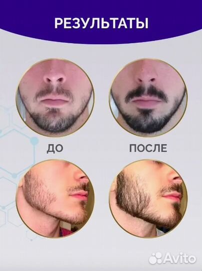 Minoxidin 5% original в наличие