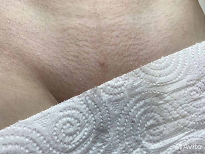 Депиляция,воском