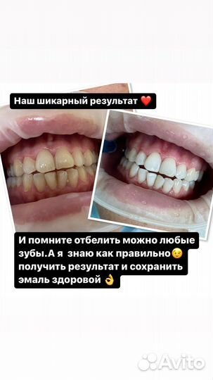 Здоровые,белоснежные зубы