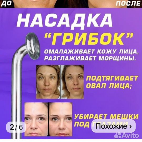 Дарсонваль ДЕ 212 карат