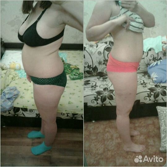 Вакуумно-роликовый массаж