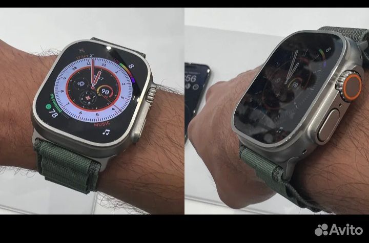 SMART watch