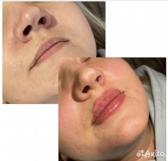 Услуги косметолога