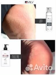 Мягкое лезвие для пяточек