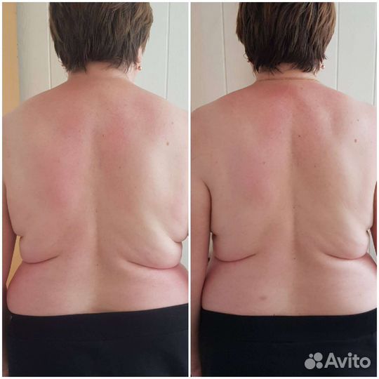 Массаж. Анапа