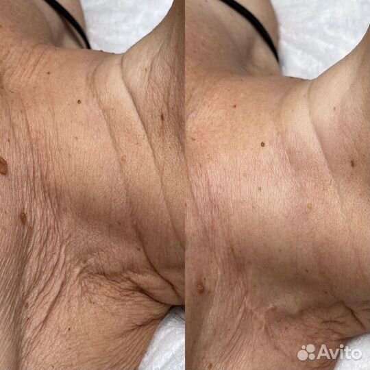 Косметолог / Массаж лица