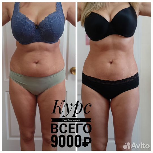 Аппаратная коррекция фигуры