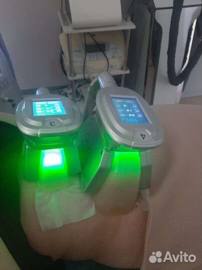 Криолиполиз