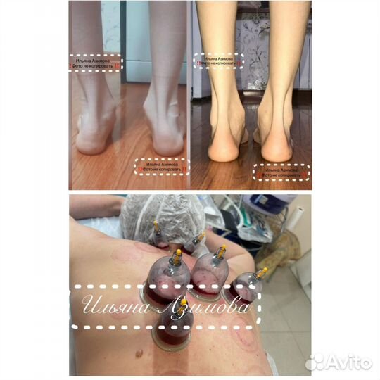 Детский Массаж на дому