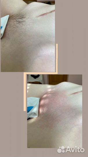 Шугаринг женский /мужской