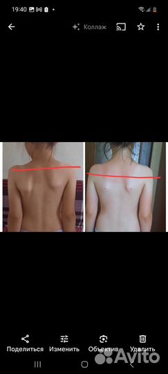 Массаж на дому