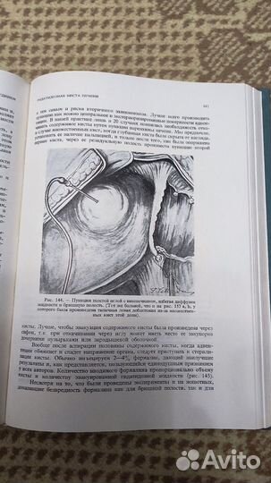 Хирургия печени и внутрипеченочных желчных путей