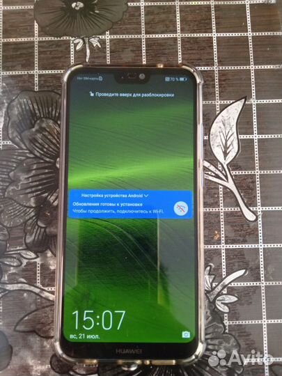 HUAWEI P20 Lite, 4/64 ГБ