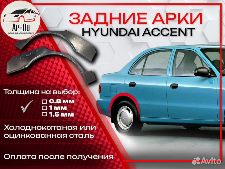 Ремонтные арки на Hyundai Accent