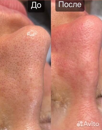 Массаж лица,расслабляющий массаж тела,чистка лица