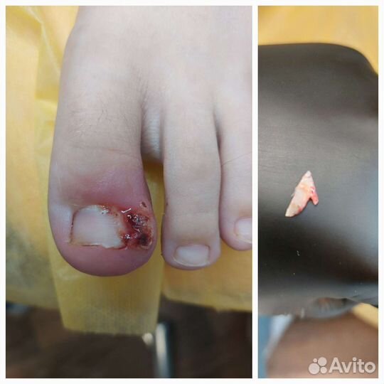 Подолог студия подологии выезд на дом